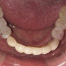 심플인플란트치과의원 이미지