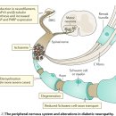 Re: SOD, 알파리포산, 비타민 B12, 카르니틴 .. 당뇨병성 신경통 치료효과 2020 이미지