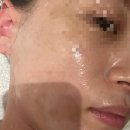 도연 | 부산웨딩 동래윤곽관리 유명한 도연에스테틱 솔직 후기! (통증없이 시원함)