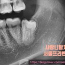 서울프리벤치과의원 네이버블로그