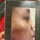 에르피엘에스테틱 | [아중리 피부관리] 피부 타입별 맞춤 관리, 피엘르 에스테틱 방문 후기