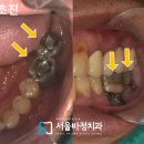 서울바정치과의원 이미지