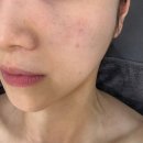 수원 영통 피부관리 웨딩케어 슬기로운 에스테틱 콜라겐벨벳관리