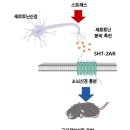 ■ 근육 긴장 이상증 (Dystonia)의 원인. 증상. 진단. 치료 이미지