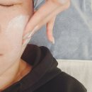 검단페이스관리 뷰티바이니 쳐진 볼살을 이마까지 끌어올려 젊음 찾음