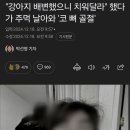 &#34;강아지 배변 치워달라&#34; 했다가 주먹 날아와 &#39;코 뼈 골절&#39; ㄷㄷ 이미지