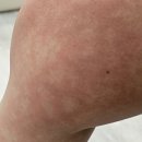 세실로 | 해운대 에스테틱 온숨 뷰티웰니스라운지ㅣ고압산소챔버 원적외선온열 프로그램 체험 솔직 후기