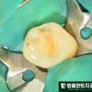 범플란트치과의원 네이버블로그