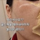강스킨바디