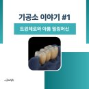 나노라이너치과기공소 | 알파베러랩, 트윈제로와 아름 밀링머신을 도입하다