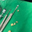 세상모든사랑니치과의원 | 내돈내산 발산역 ‘세상모든사랑니치과의원’ 사랑니 발치 병원 찐추천 후기