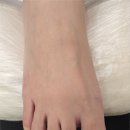 더네일에스샵 | 목동발톱무좀 관리 찐만족 후기 네일샵에스 아를솔즈