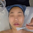 이브 | 서면에스테틱 서면아쿠아필하이푸리프팅 이브뷰티센터 후기