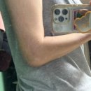 그 꼴로 산책가개? | 팔꿈치 골절 수술 6주~8주차 : 골절 수술 후 2달간 재활 기록 (리블레스cpm 렌탈 후기)