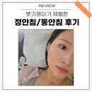 정안한의원 | 목동 동안침/정안침 후기 | 얼굴 붓기 잡는 한의원 시술 체험기