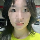 브이(V) | 강남 피부과 브이라인을 위한 얼굴 v슬림밤 후기