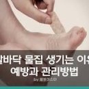 발바닥 물집 생기는 이유 효능 및 증상 관리법 이미지