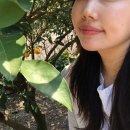 메디체인 | [부평역피부과/내돈내산] 브이메디스파_여드름 피부 관리 솔직후기와 자세한 전후 사진