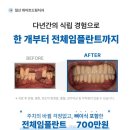 보일치과기공소 이미지