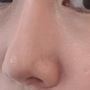 인셀덤다온