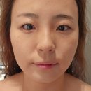 에스뷰티풀피부관리 | 용인 성복동 피부관리 뷰티풀미 물방울 초음파 수분케어 후기