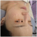 아이스킨 이미지