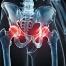 산운로160번길 | &lt;운동공간 픽스앤빌드&gt;발바닥·무릎 통증의 숨은 원인 ‘고관절 불균형’/운중동pt,서판교pt