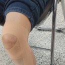 테이핑 및 마사지 이미지