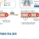 모산이비인후과의원 네이버블로그