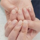 힐링네일 이미지