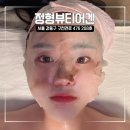 강동구피부관리 정형뷰티어겐 후기 한 번에 느껴진 얼굴 변화!