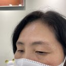 헤드샷모이스 | 분당 서판교 자연눈썹 헤드샷스칼프모이스 눈썹문신 대만족 후기