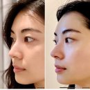 (주)거성케어 | 다산피부관리 뷰렌뷰티 윤곽관리 관리 전후 솔직후기(파메스테틱 할인구매 링크)