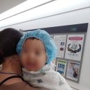 구개열 수술 후, 도움받았던 식사 대용품들