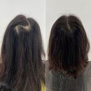 스칼프K 이미지