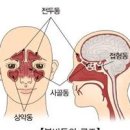 급성,만성 부비동염 이미지