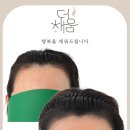 더 채움 스칼프