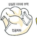 휴먼치과의원 이미지