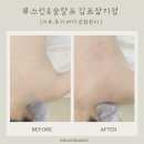 뷰스킨&숲칼프김포