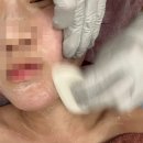 산남동피부관리 퀸스킨앤바디 환골얼굴윤곽술 예민 피부 후기