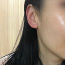 강동구피부관리 the기품 에스데틱에서 얼굴관리 받고 온 내돈내산 후기
