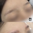 브로우장 | 구리 여자눈썹 붉은눈썹커버 완성된 후기 (feat 헤어스트록)