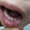 처음가는소아치과의원 이미지