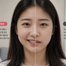 마비 | 광주 구안와사(벨마비) 진단 후기｜안면신경마비 초기 증상부터 치료까지