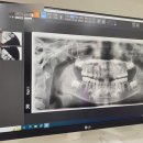 처음가는소아치과의원 이미지