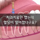 해운대뉴욕치과의원 | 해운대신도시치과 신경치료 후 혈당이 내려간다고요?