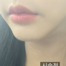 리부팅의원 네이버블로그