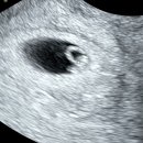 (주)91팩토리 | 임신극초기, 피검사 수치 더블링 결과 임밍아웃 이벤트 풍선세트