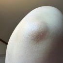올바르다케어