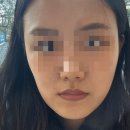 뷰리플한의원 이미지